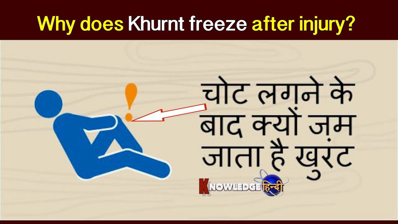  Why Does Khurnt Freeze After