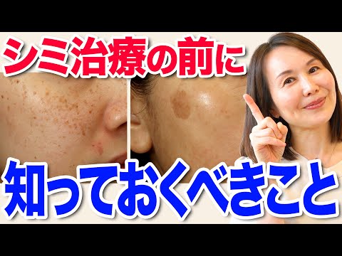 保存版】シミ治療を発生メカニズムから徹底解説！ - YouTube