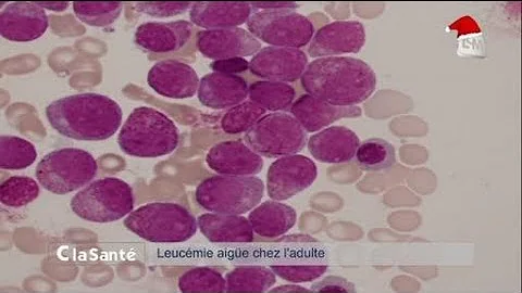 Qu'est-ce qui provoque le cancer de la moelle osseuse