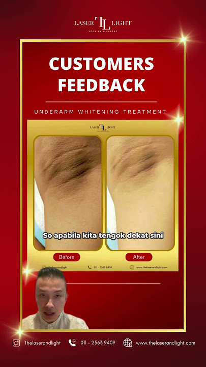Siapa kata takde treatment untuk putihkan balik ketiak?