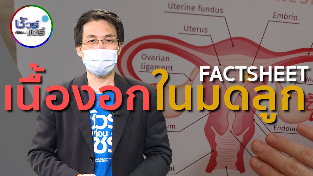 ชัวร์ก่อนแชร์ FACTSHEET : เนื้องอกในมดลูก