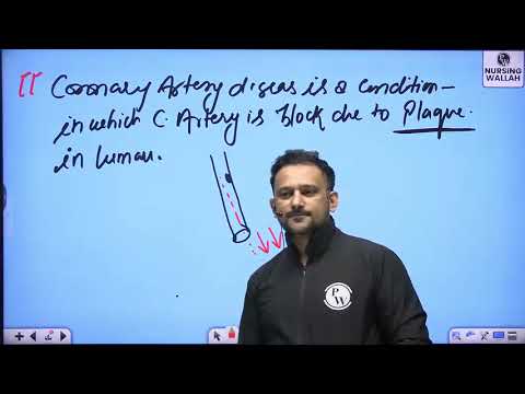 34 Cardiovascular System 34   Coronary Artery Disease   DPP Quiz Will