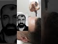 4 عمليات تجميل مجرم يختفي بوجه شقيقه قبل أن تسقطه الشرطة
