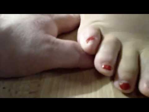 Hand and Finger crush - Barefoot