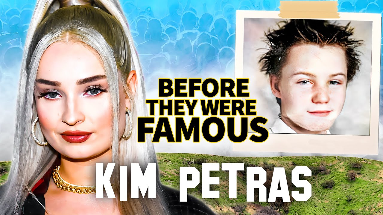 Kim Petras' Post-Surgery Appearance