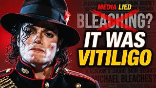 Michael Jackson’s Real Vitiligo Story: The Truth They Didn’t Want You to Know