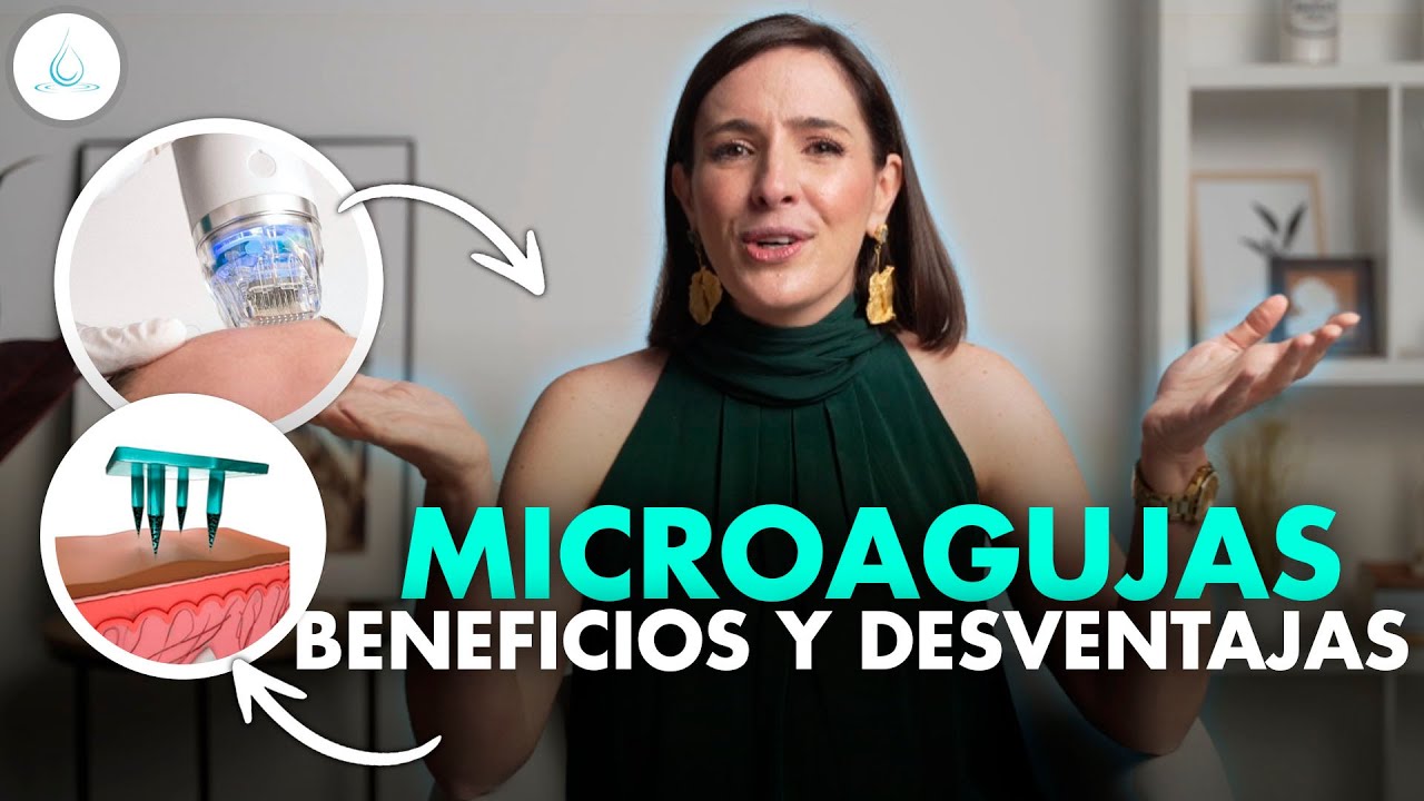 🔴 MICRONEEDLING (Demaroller, Dermapen, Nanopore) Lo que necesitas saber! @drapilarochoa -Dermatologa