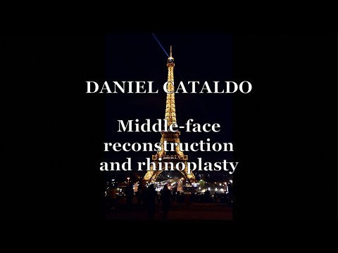Middle face reconstruction and rhinoplasty