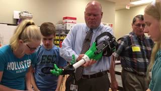 Prosthetic Arm Final Fitting