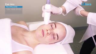 LIFTERA - Non Invasive Facelift with Line Type Cartridge & Pen Applicator