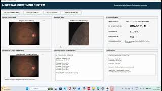 Hybrid Quantum Machine Learning Platform for early Disease Detection TeamID- 146755 Aarogya Drishti 