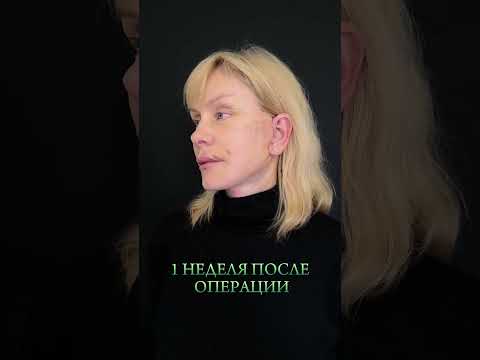 Посмотрите историю моей