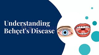 Understanding Behçets Disease Or Silk Road Disease