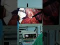 Surgery Laparoscopic Clinical Performance: IKEDA FHD 9001 Imaging System