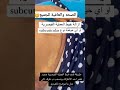 ازله خيوط العمليه القيصريه 