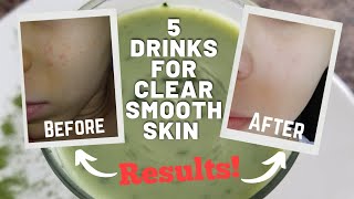 NOT NASTY Drinks to Clear OUT Acne | Vegan Friendly ッ | Divine Fro