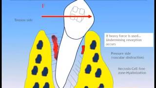 Dental Treatment: Accelerated Orthodontics Jan 31, 2017 screenshot 5