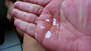 Oliva azeite varizes massagem com de para