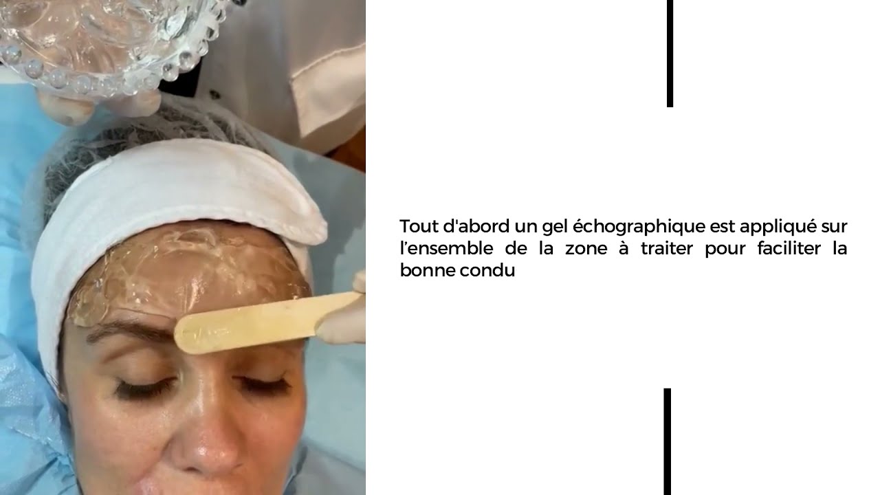 Ouverture du regard avec les HIFU ( Ultrasons focalisés)