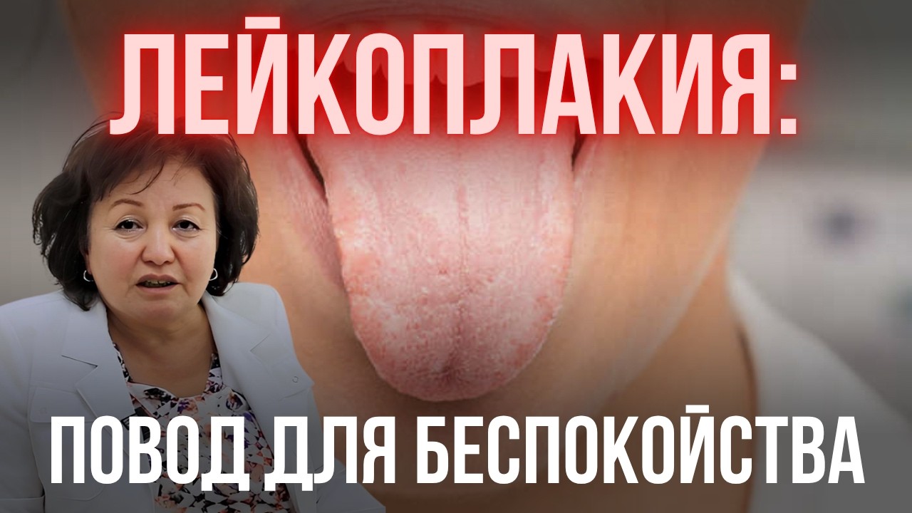 ЛЕЙКОПЛАКИЯ: ПОВОД ДЛЯ БЕСПОКОЙСТВА?