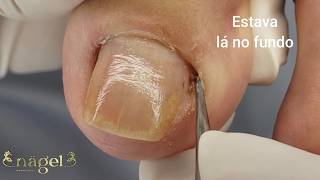 Como Identificar a Espícula? (aula)  #satisfying #nails