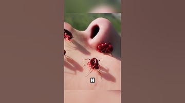 Парашют не раскрылся но она выжила @zackdfilms