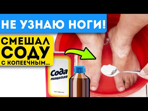 Видео: Как удалить сухую кожу с ног с помощью английской соли