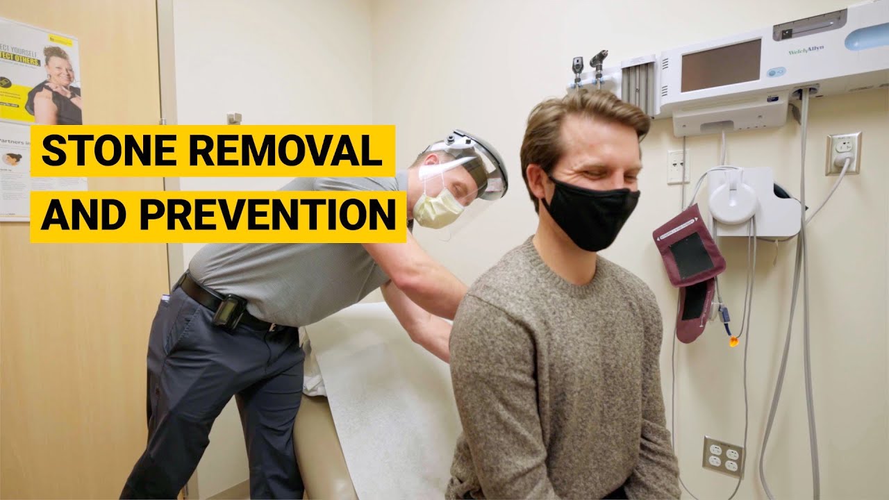 UI Health Care Kidney Stone Removal and Kidney Stone Prevention 