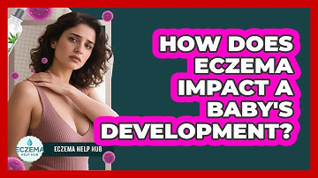 How Does Eczema Impact A Baby