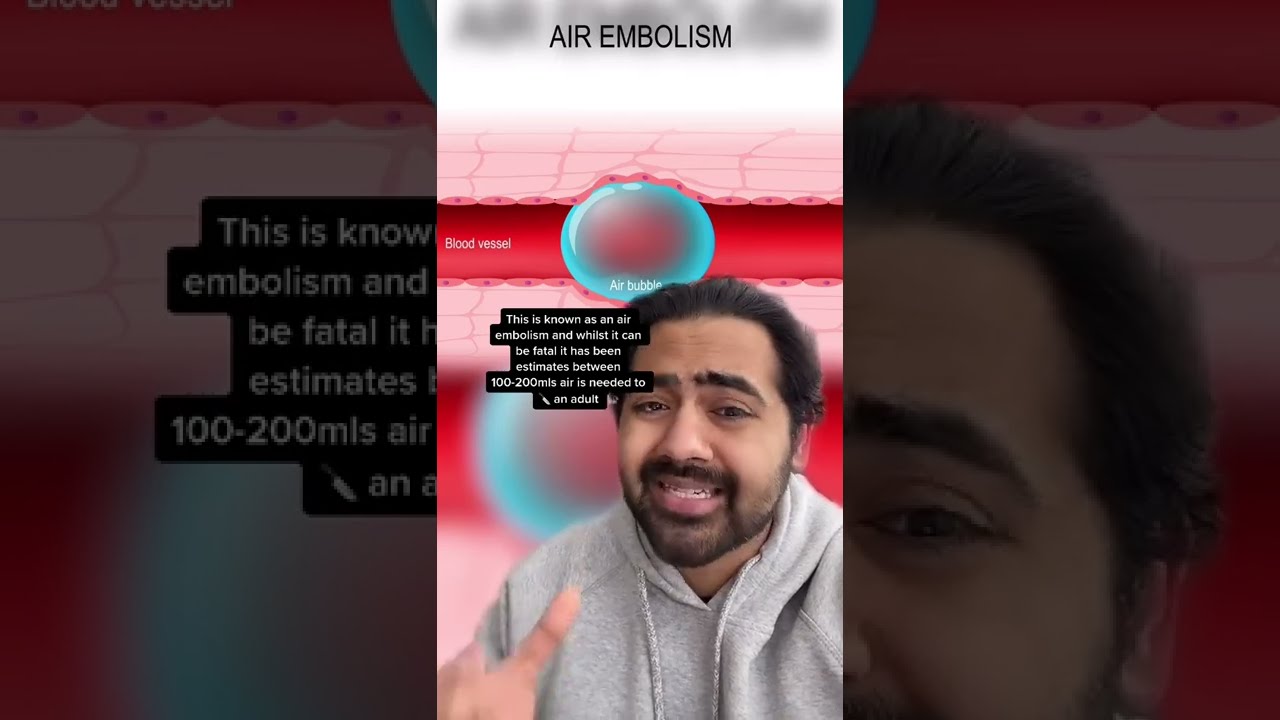 Doctor Reacts To SECRET Air Bubbles Shorts