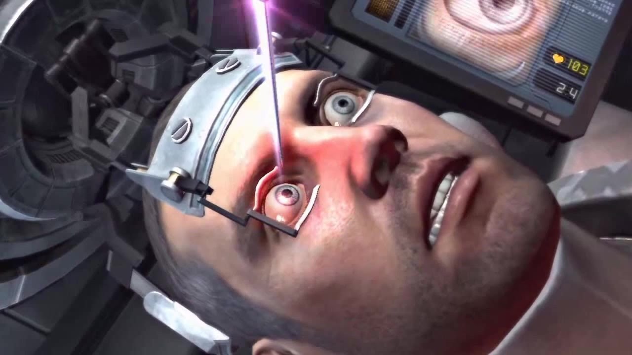 myopia lézeres műtét videó