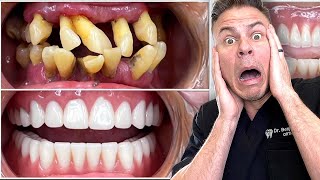 The Craziest Dental Transformation Ever!