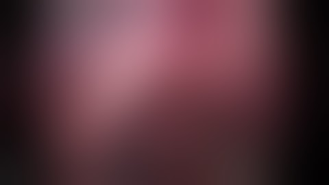 Laparoscopic high oesojejunal anstomosis after extended total gastrectomy