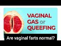 Are vaginal farts normal ?|Does your vagina fart during sex?|causes of vaginal fart#Queef