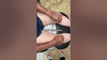 Sun Damage Is Terrifying