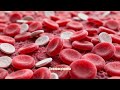 USMLE REVIEW PROGRAM :Portal Hypertension