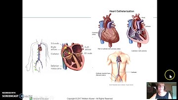 perfusion/cardiovascular part 1