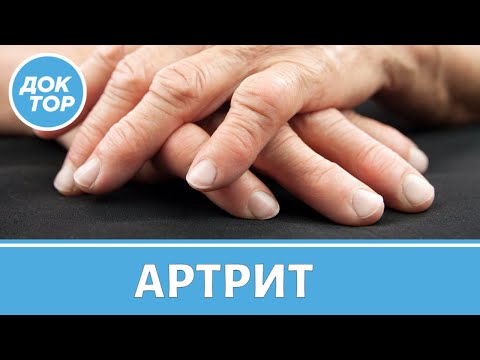 Симптомы артрита