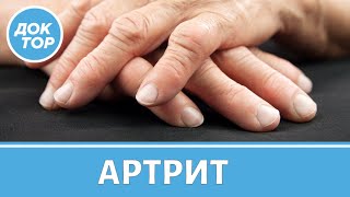 Симптомы артрита