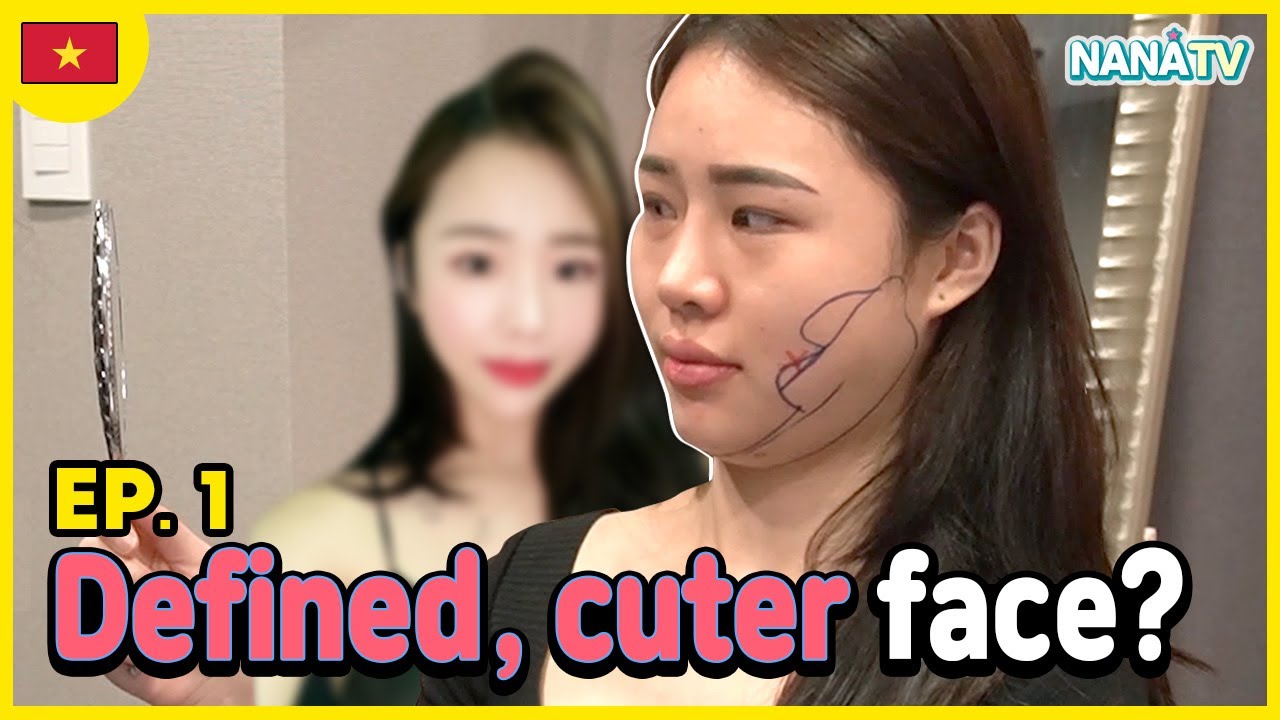 [SUB] Ep1. Face liposuction with Thread Lifting vlog Buccal Fat