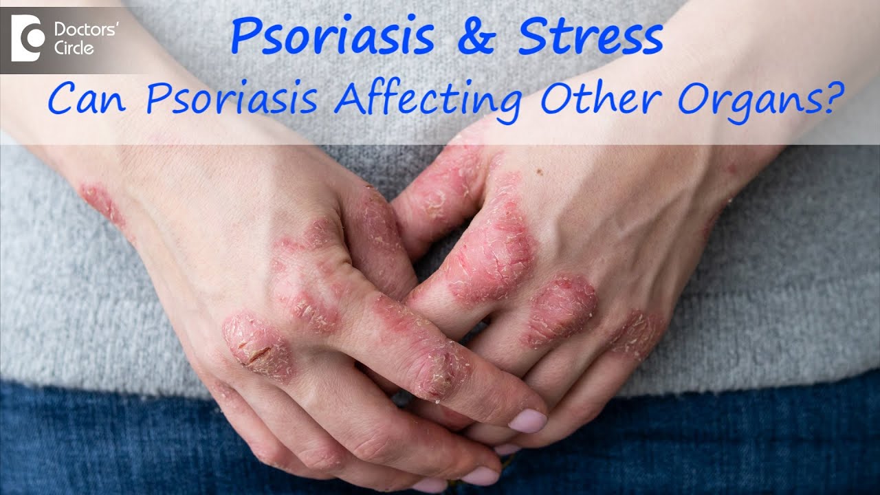 what organs does psoriasis affect
