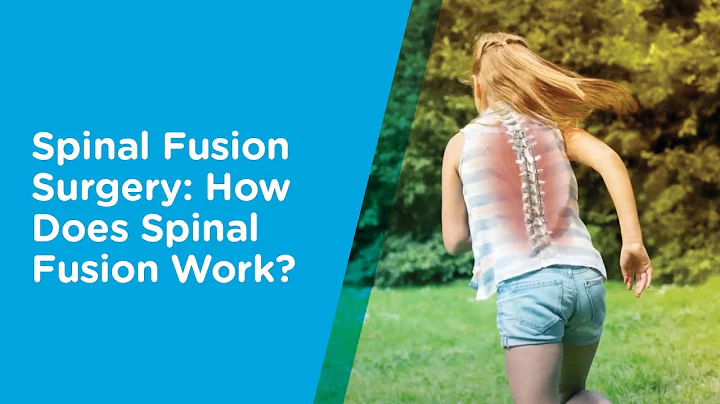 Spine Fusion Surgery Helps Correct Your Child’s Scoliosis