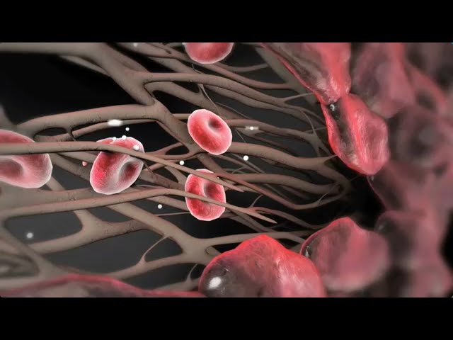 Atherosclerosis (2009) - YouTube