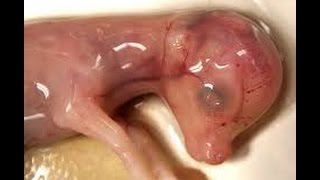 cow fetus  جنين البقر داخل الرحم