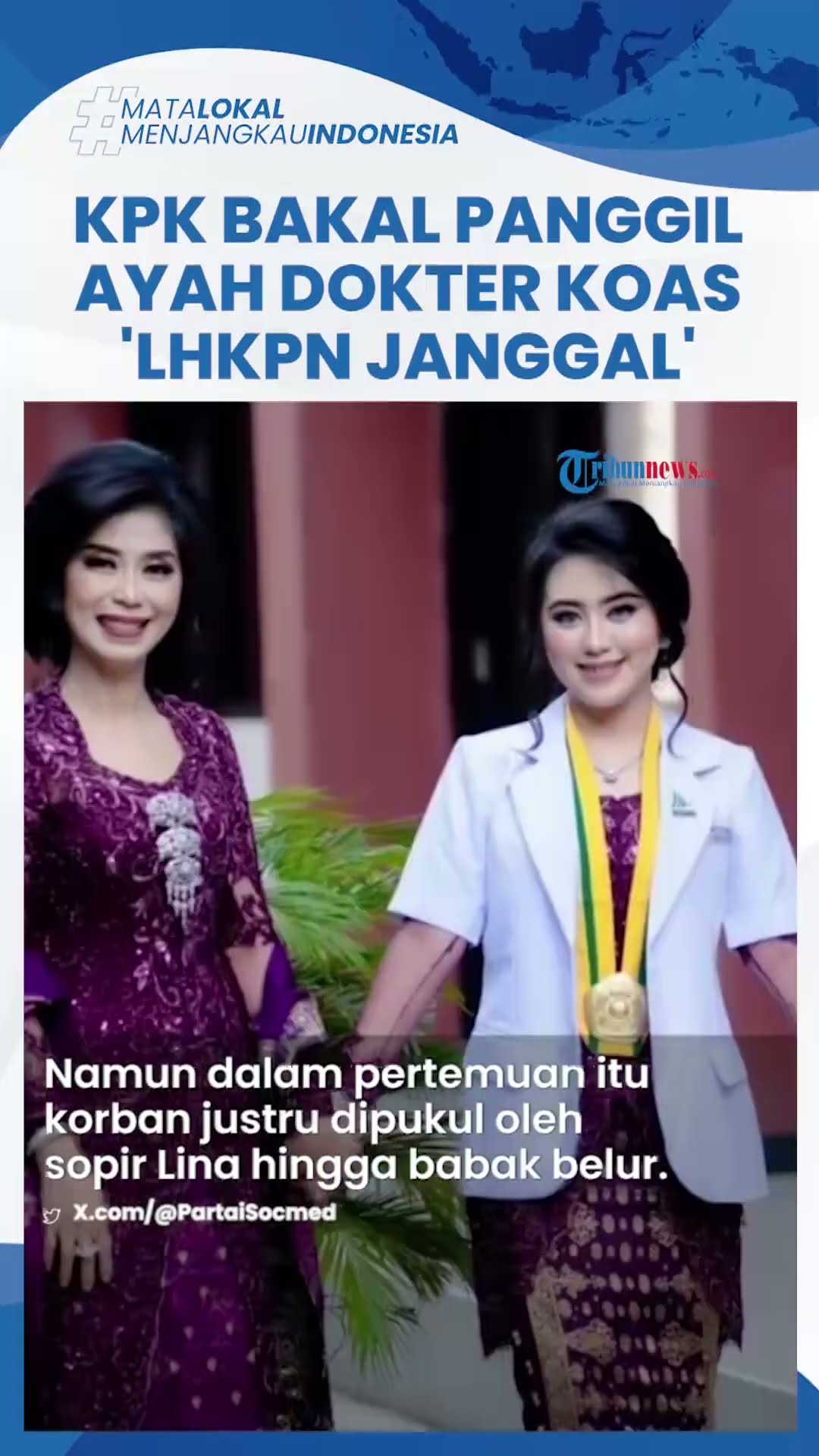 KPK Bidik Harta Ayah Lady Pemicu Dokter Koas Dianiaya Gegara Jadwal Piket, Disebut Ada Kejanggalan