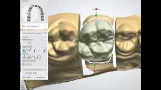 Intro to Dental CAD/CAM - The Tools screenshot 4