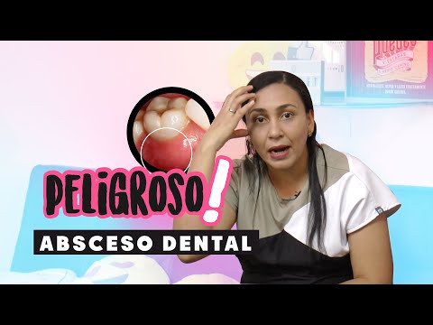 😲😱 Absceso dental: Causas y tratamiento | ¿Cómo desinflamar Absceso Dental? | Infecciones dentales