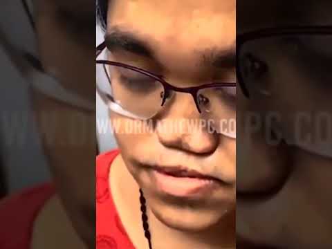 Nose Surgery In India - A Rare Case | Before And After Results | Dr Mathew PC #shorts