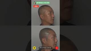 [분당 클라라] SMP 40%시술 할인 곧 마감! 서두르세요~ #두피문신