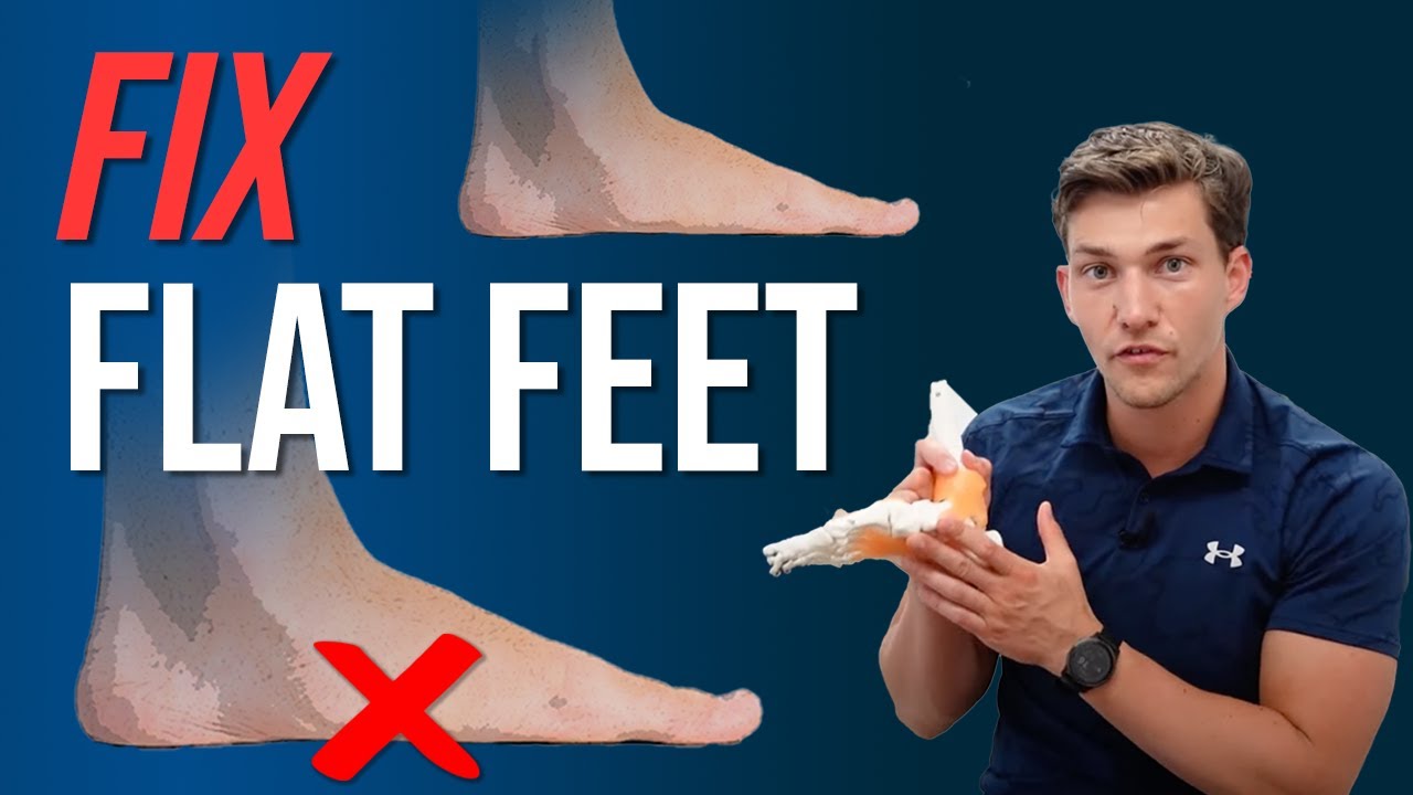 How to Fix Flat Feet Without Insoles! - YouTube